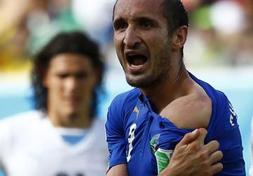 كليني مدافع منتخب إيطاليا بعد عضة سواريز 