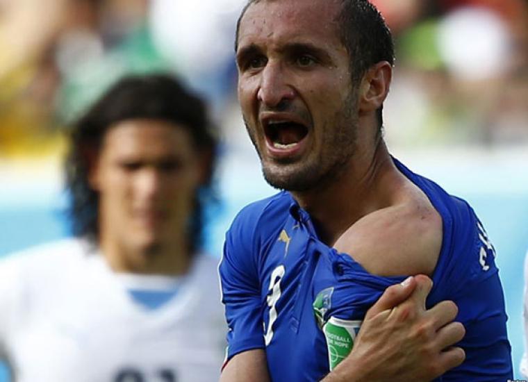 كليني مدافع منتخب إيطاليا بعد عضة سواريز 
